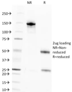 Nuclear Antigen Antibody (NM106), Novus Biologicals 0.2 mg | Buy Online | Novus Biologicals | Fisher Scientific